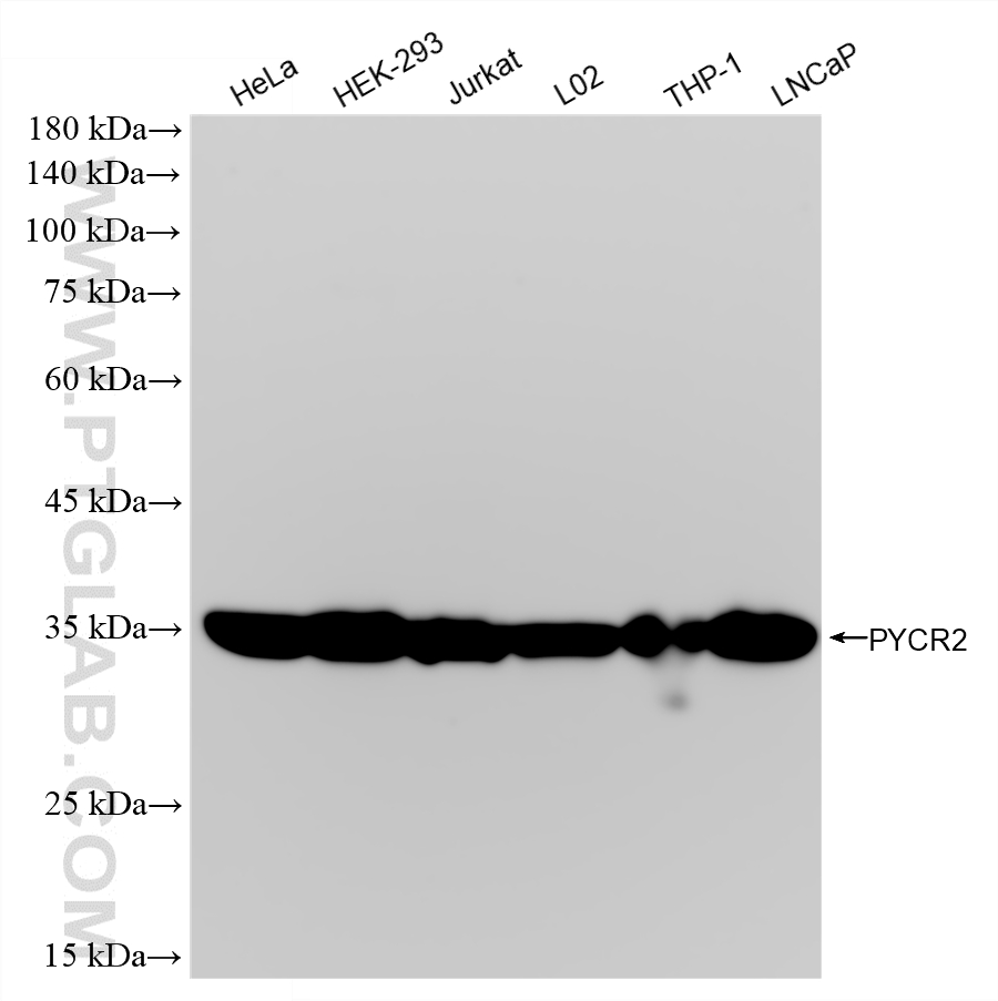 WB analysis using 87985-2-RR WB analysis using 87985-2-RR