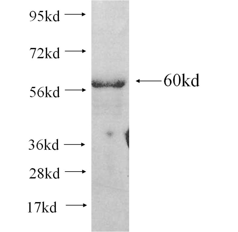 PYCR2 fusion protein Ag10918 SDS-PAGE