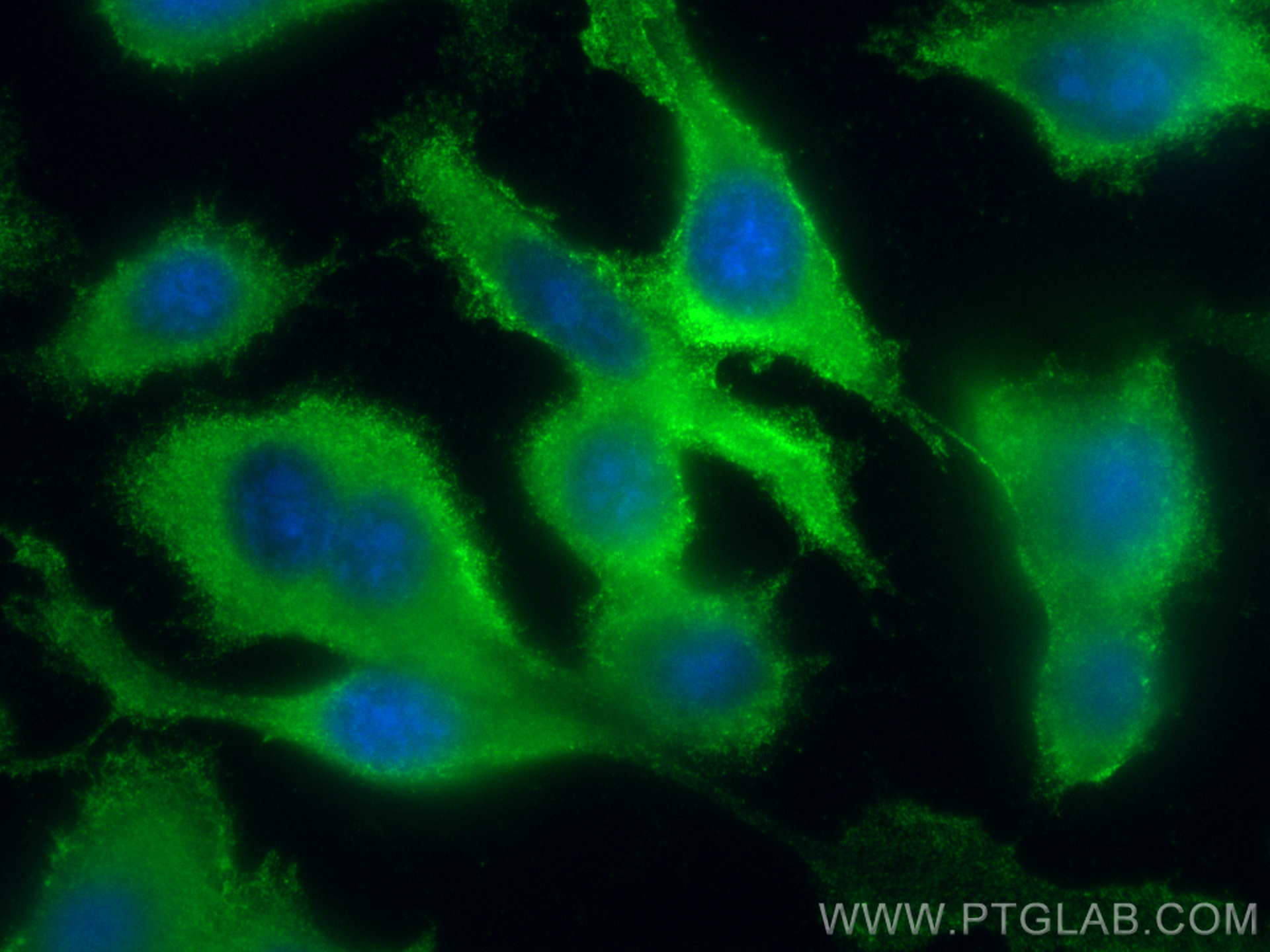 Immunofluorescent analysis of (-20°C Ethanol) fixed PC-3 cells using CoraLite® Plus 488 PYCRL antibody (CL488-68087, Clone: 1G7A3 ) at dilution of 1:200. IF Staining of PC-3 using CL488-68087