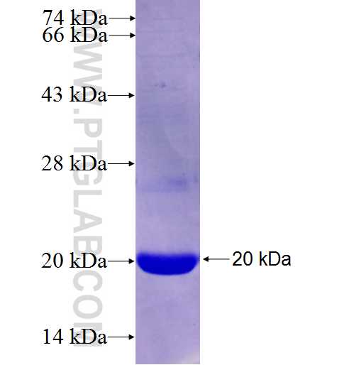 PYCRL fusion protein Ag26979 SDS-PAGE PYCRL fusion protein Ag26979 SDS-PAGE