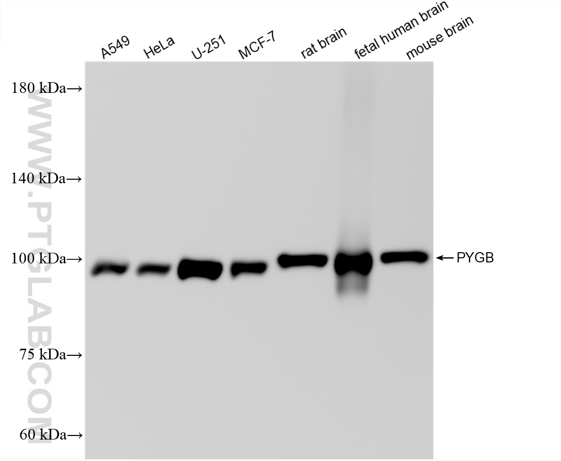 WB analysis using 86737-3-RR WB analysis using 86737-3-RR