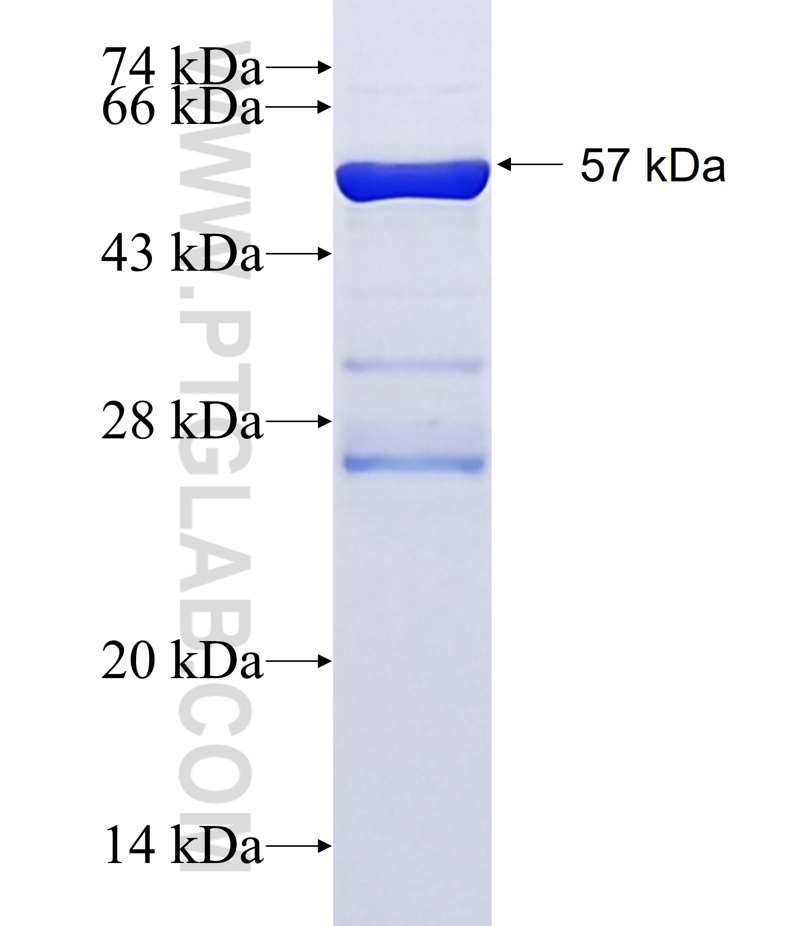 PYGB fusion protein Ag2732 SDS-PAGE