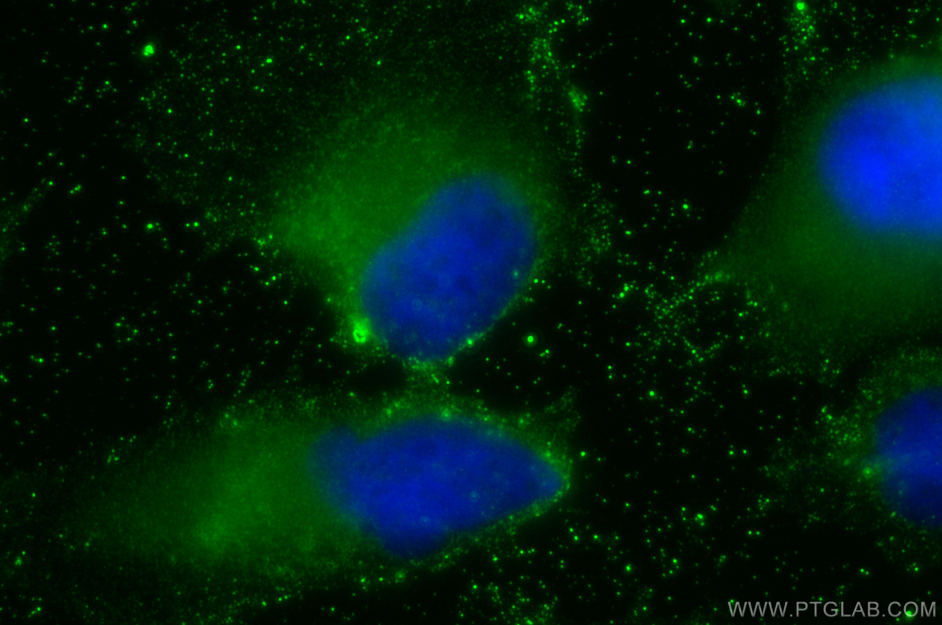 IF Staining of U-251 using 66769-1-Ig (same clone as 66769-1-PBS)