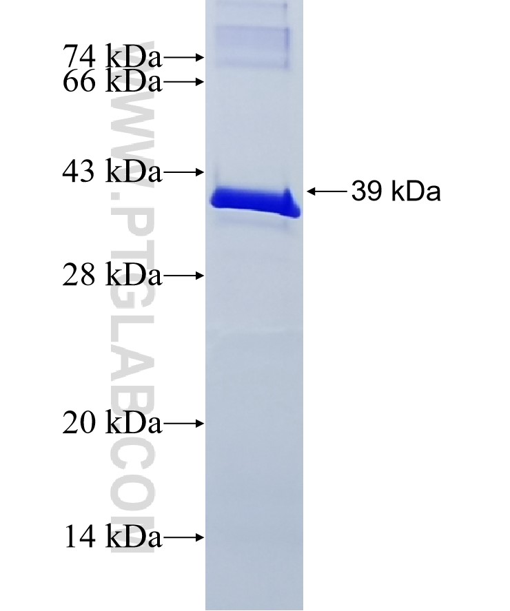 PYGL fusion protein Ag8550 SDS-PAGE