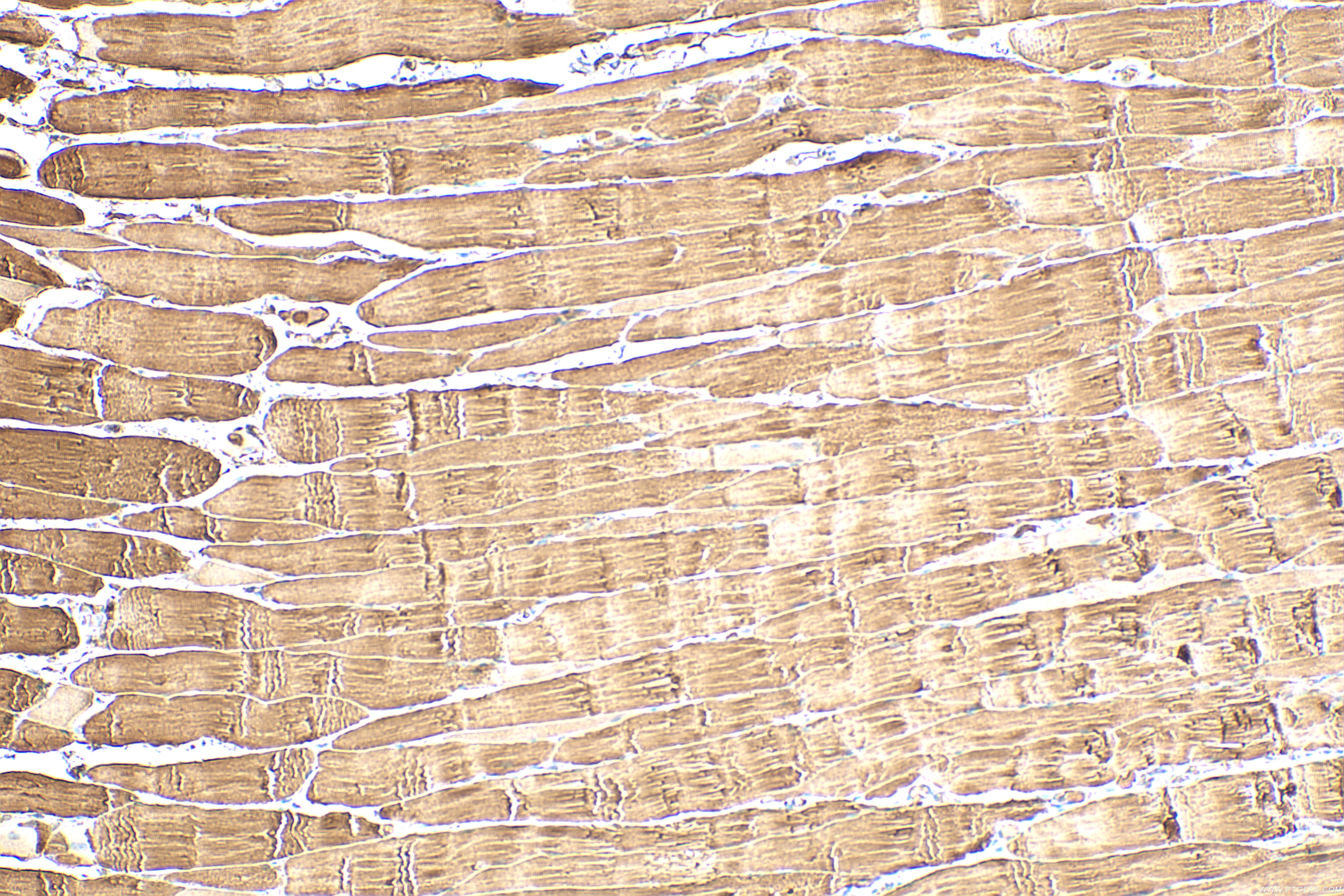Immunohistochemical analysis of paraffin-embedded rat skeletal muscle tissue slide using 19716-1-AP (PYGM-Specific antibody) at dilution of 1:500 (under 10x lens). Heat mediated antigen retrieval with Tris-EDTA buffer (pH 9.0). IHC staining of rat skeletal muscle using 19716-1-AP