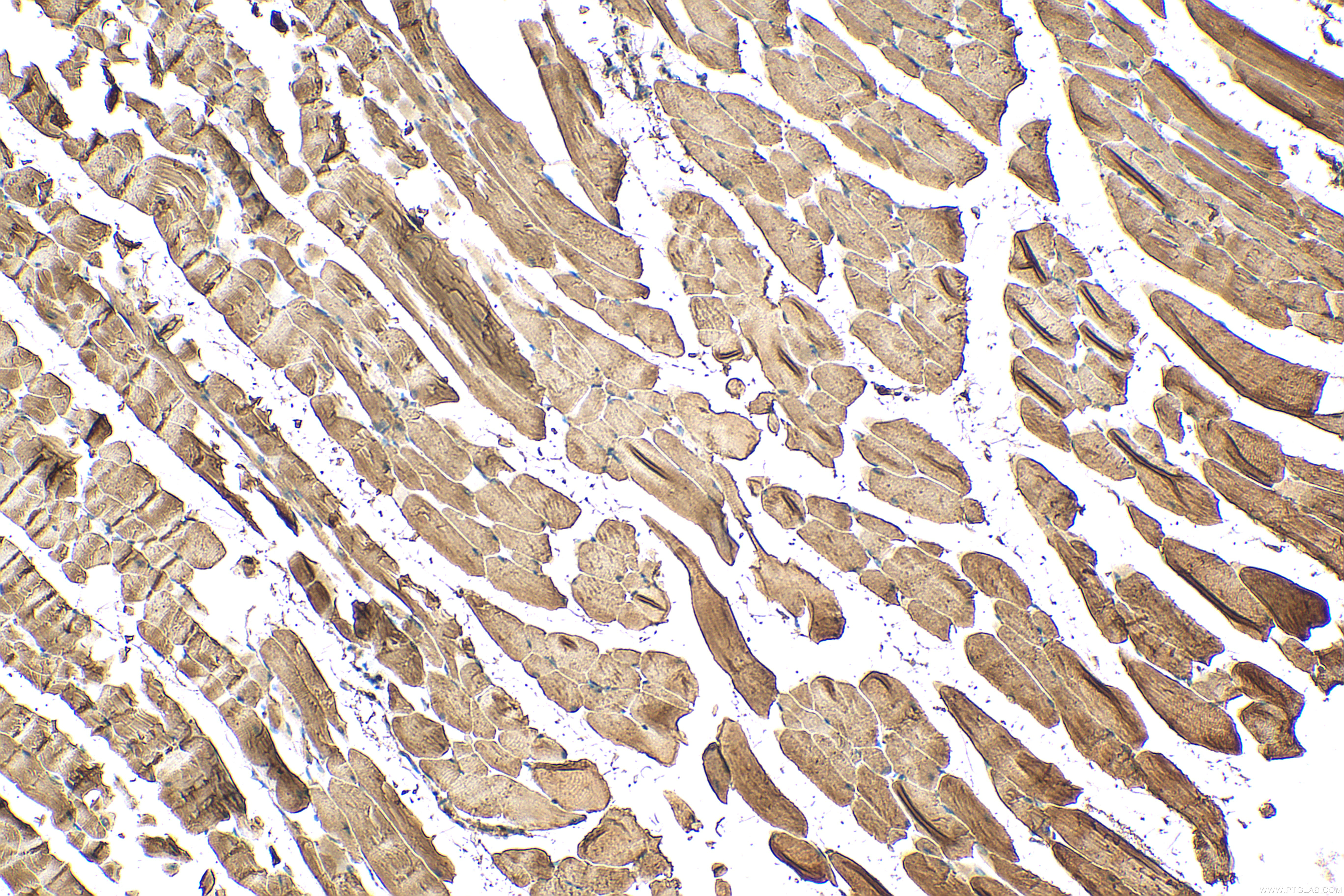 Immunohistochemical analysis of paraffin-embedded mouse skeletal muscle tissue slide using 19716-1-AP (PYGM-Specific antibody) at dilution of 1:500 (under 10x lens). Heat mediated antigen retrieval with Tris-EDTA buffer (pH 9.0). IHC staining of mouse skeletal muscle using 19716-1-AP