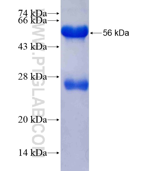 PYGO1 fusion protein Ag18894 SDS-PAGE PYGO1 fusion protein Ag18894 SDS-PAGE