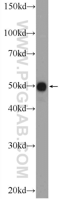 WB analysis of MDA-MB-453s using 11555-1-AP