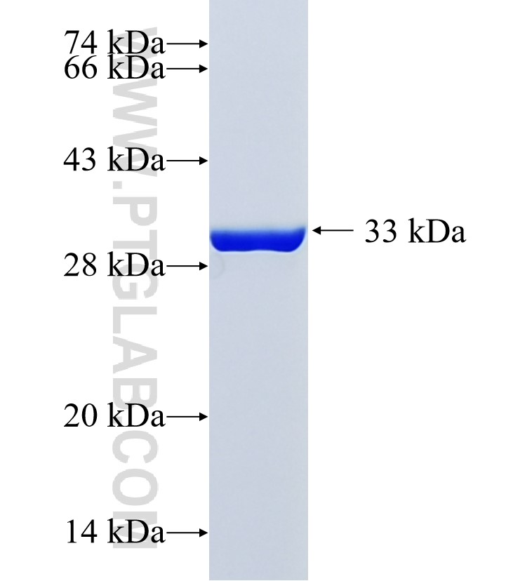 PYHIN1 fusion protein Ag19165 SDS-PAGE PYHIN1 fusion protein Ag19165 SDS-PAGE