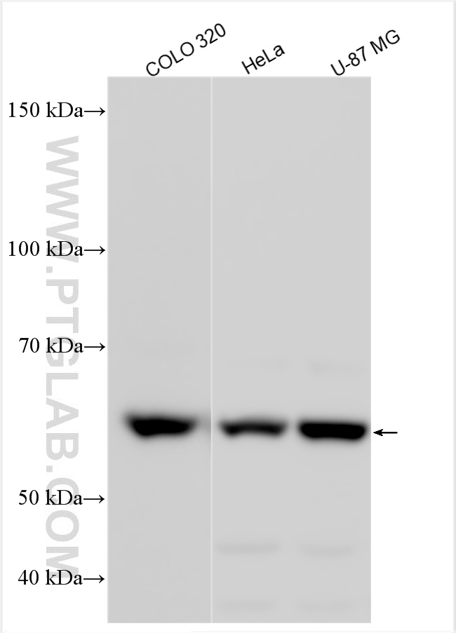 WB analysis using 31093-1-AP