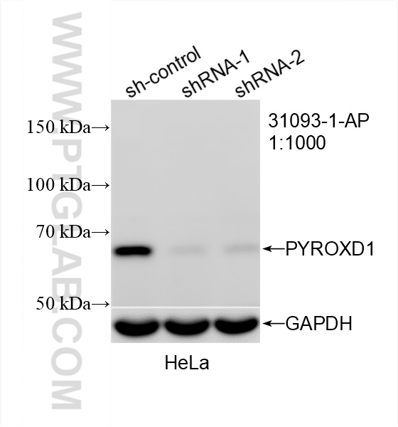 WB analysis of HeLa using 31093-1-AP