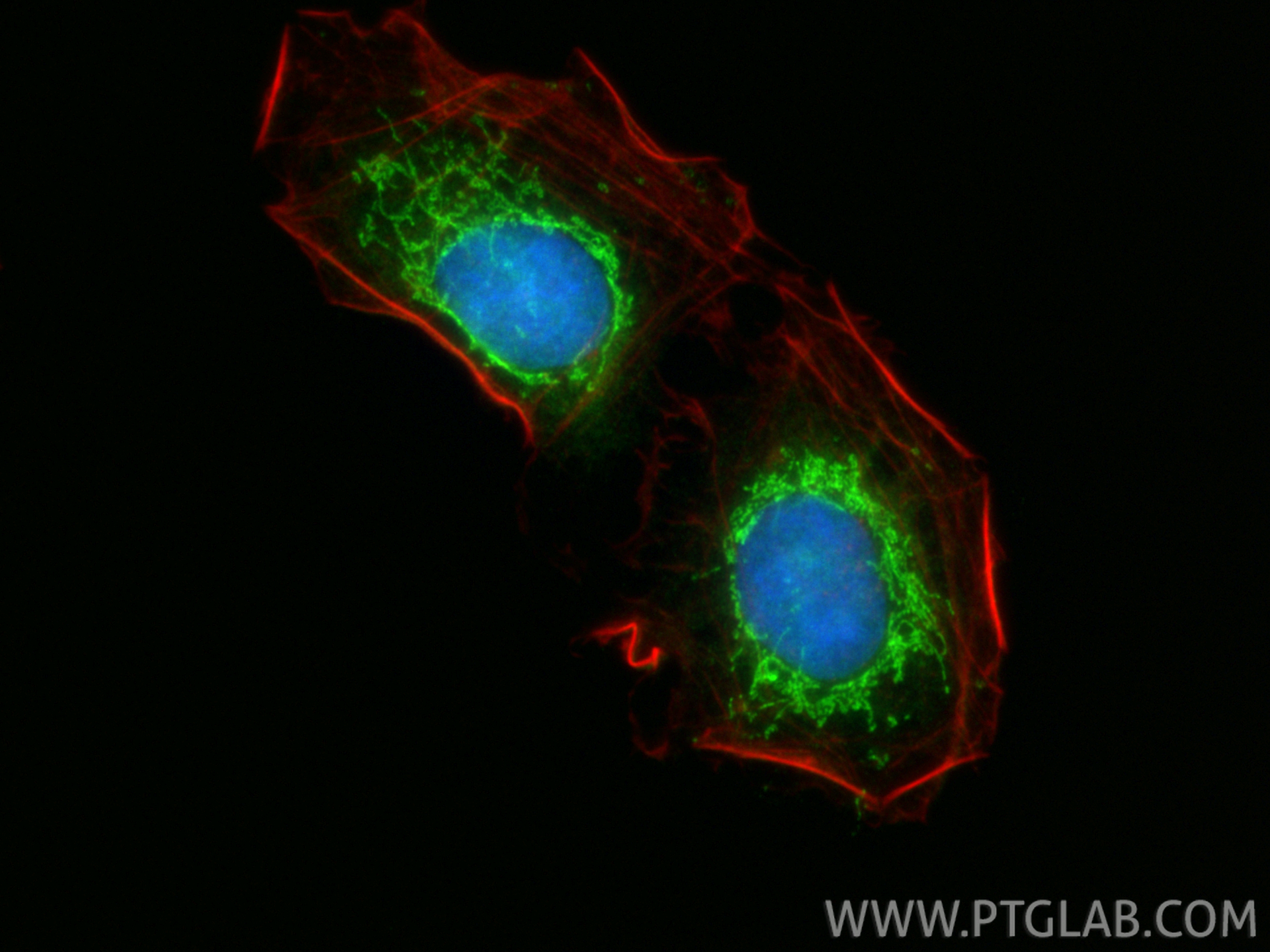 IF Staining of U2OS using 21845-1-AP