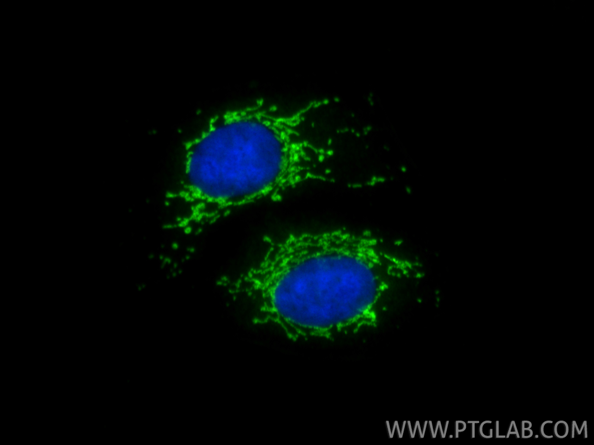 IF Staining of U2OS using 21845-1-AP