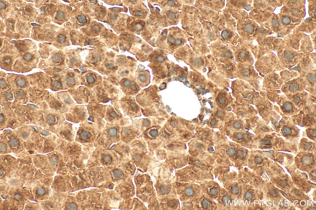 IHC staining of rat liver using 21845-1-AP