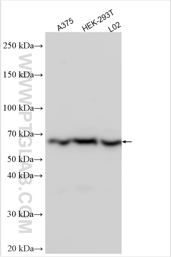 WB analysis using 21845-1-AP