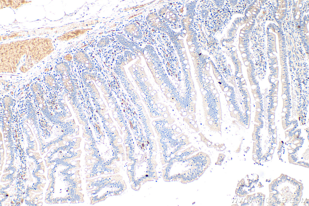 IHC staining of human small intestine using 24294-1-AP