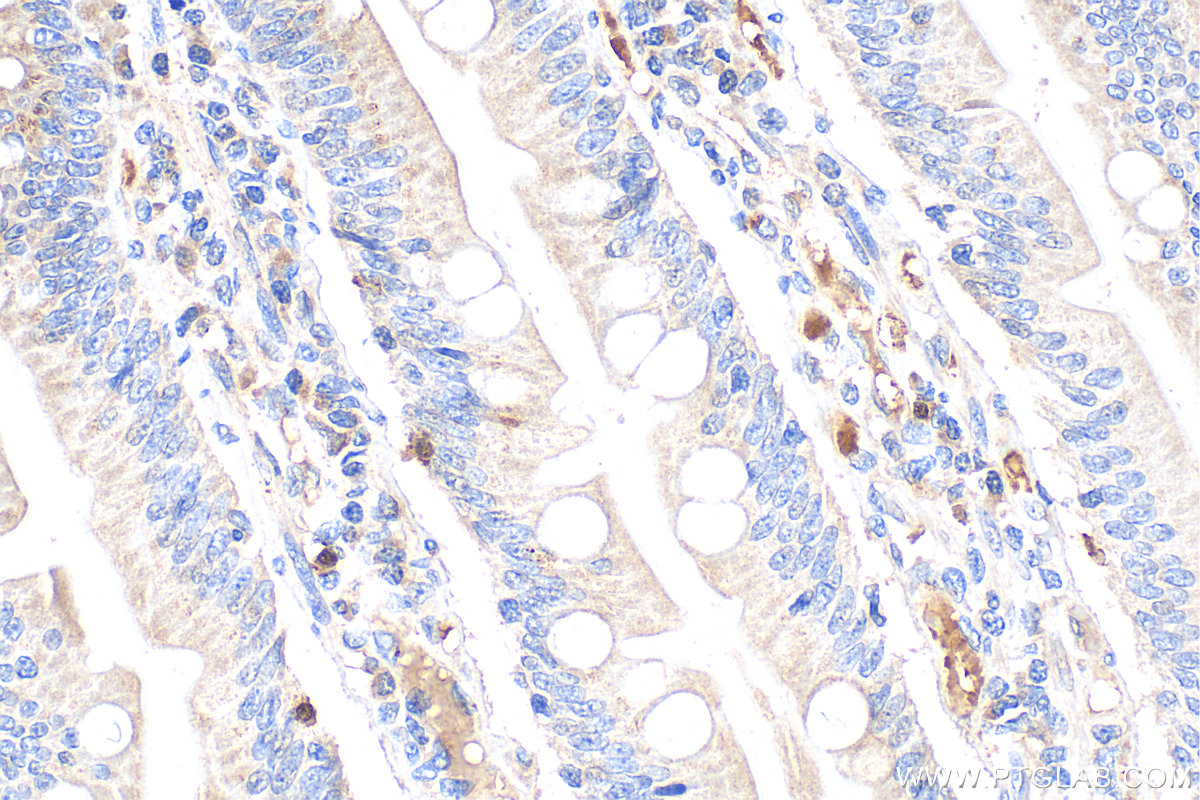 IHC staining of human small intestine using 24294-1-AP
