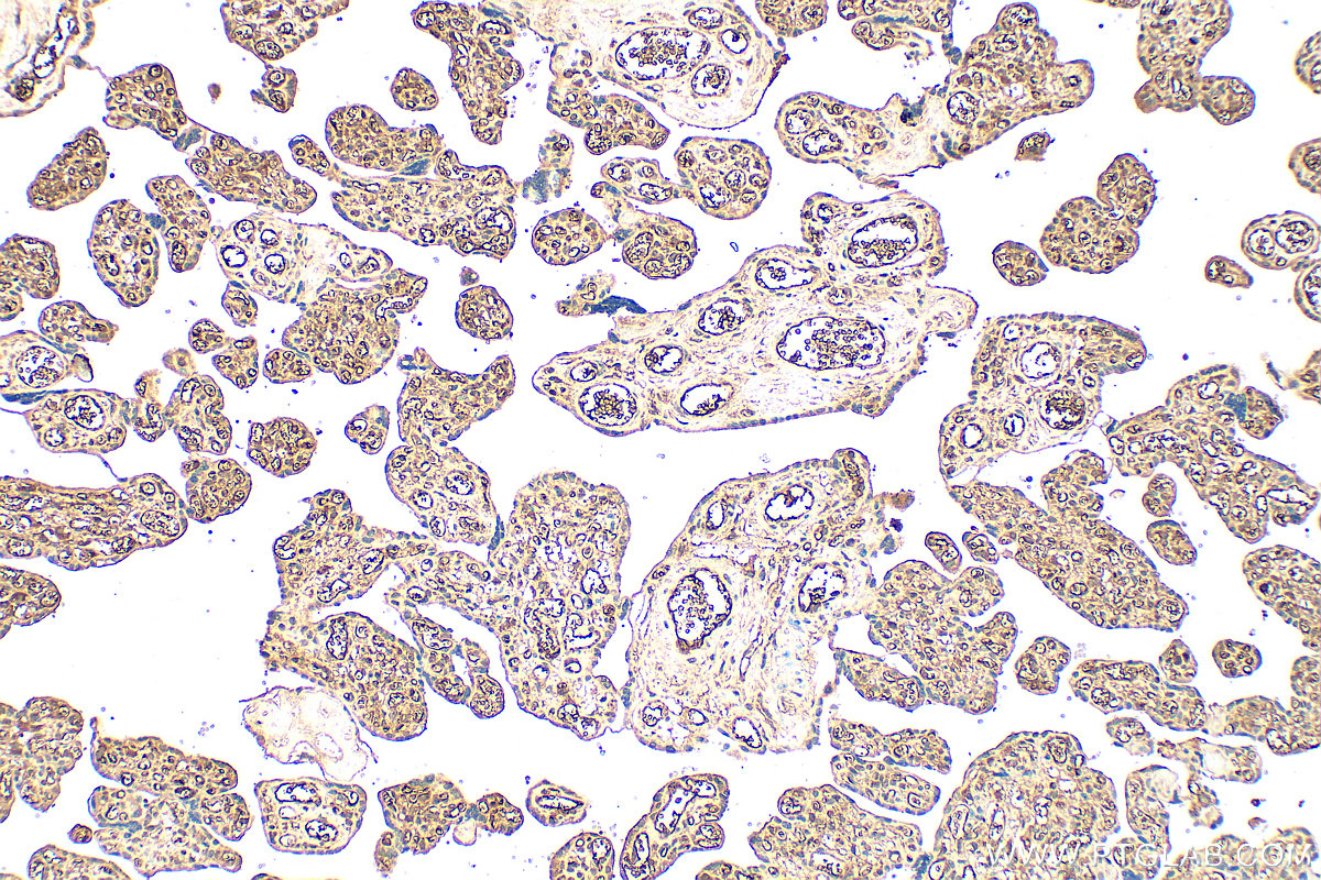 IHC staining of human placenta using 21742-1-AP