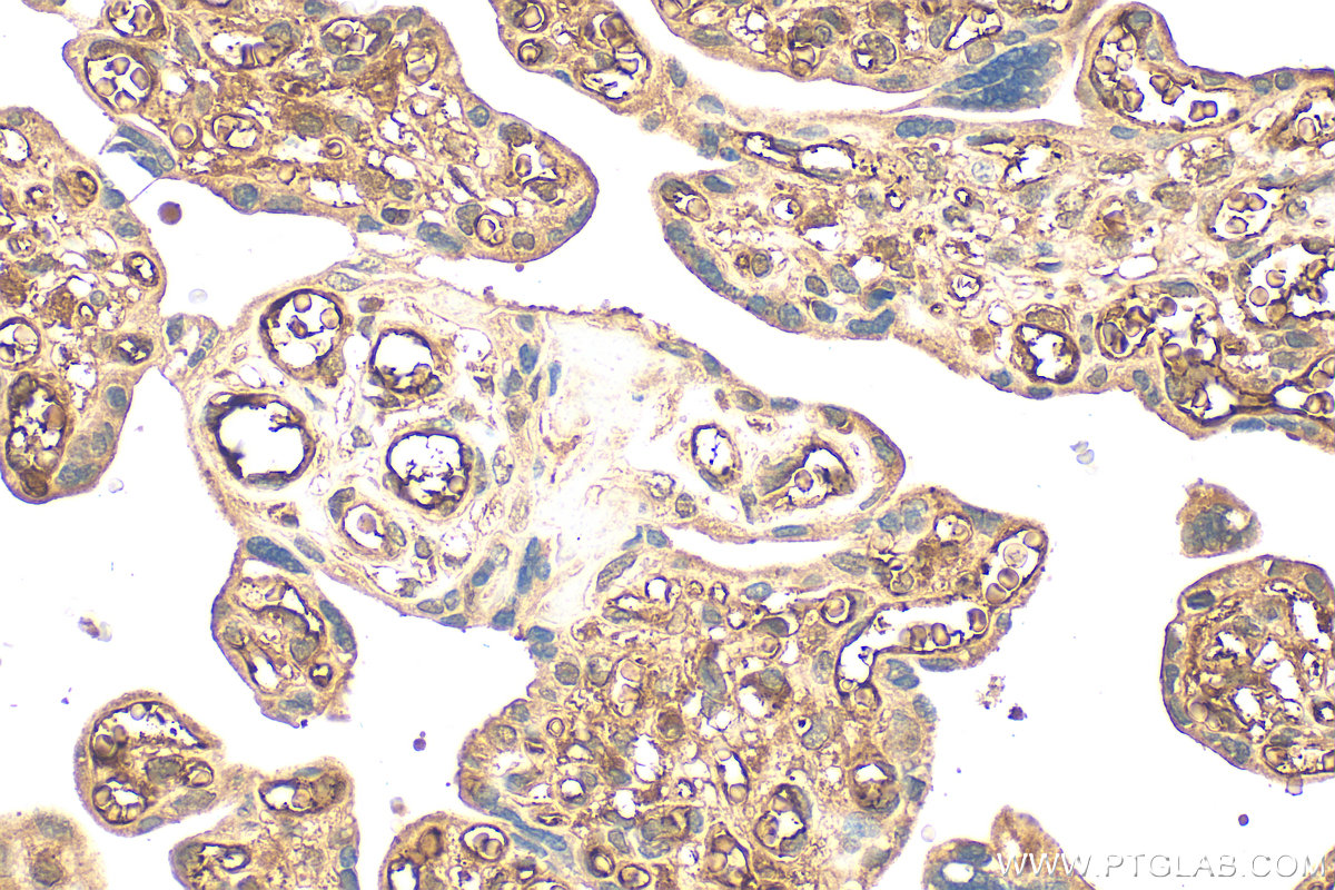 IHC staining of human placenta using 21742-1-AP