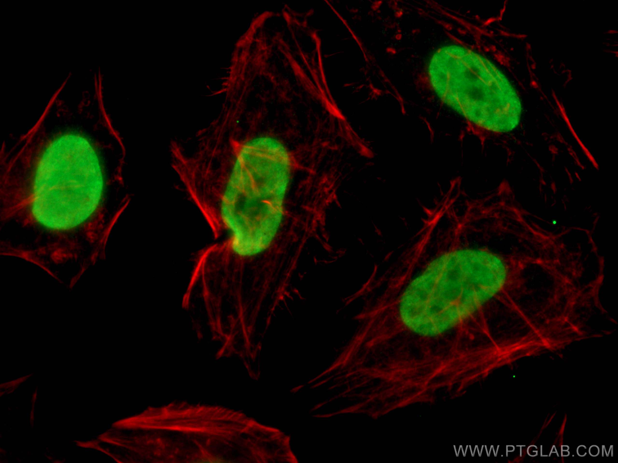 IF Staining of HeLa using 66289-1-Ig (same clone as 66289-1-PBS)