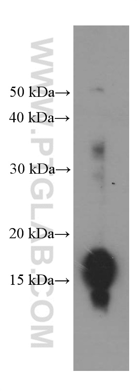 WB analysis of HeLa using 66289-1-Ig (same clone as 66289-1-PBS)