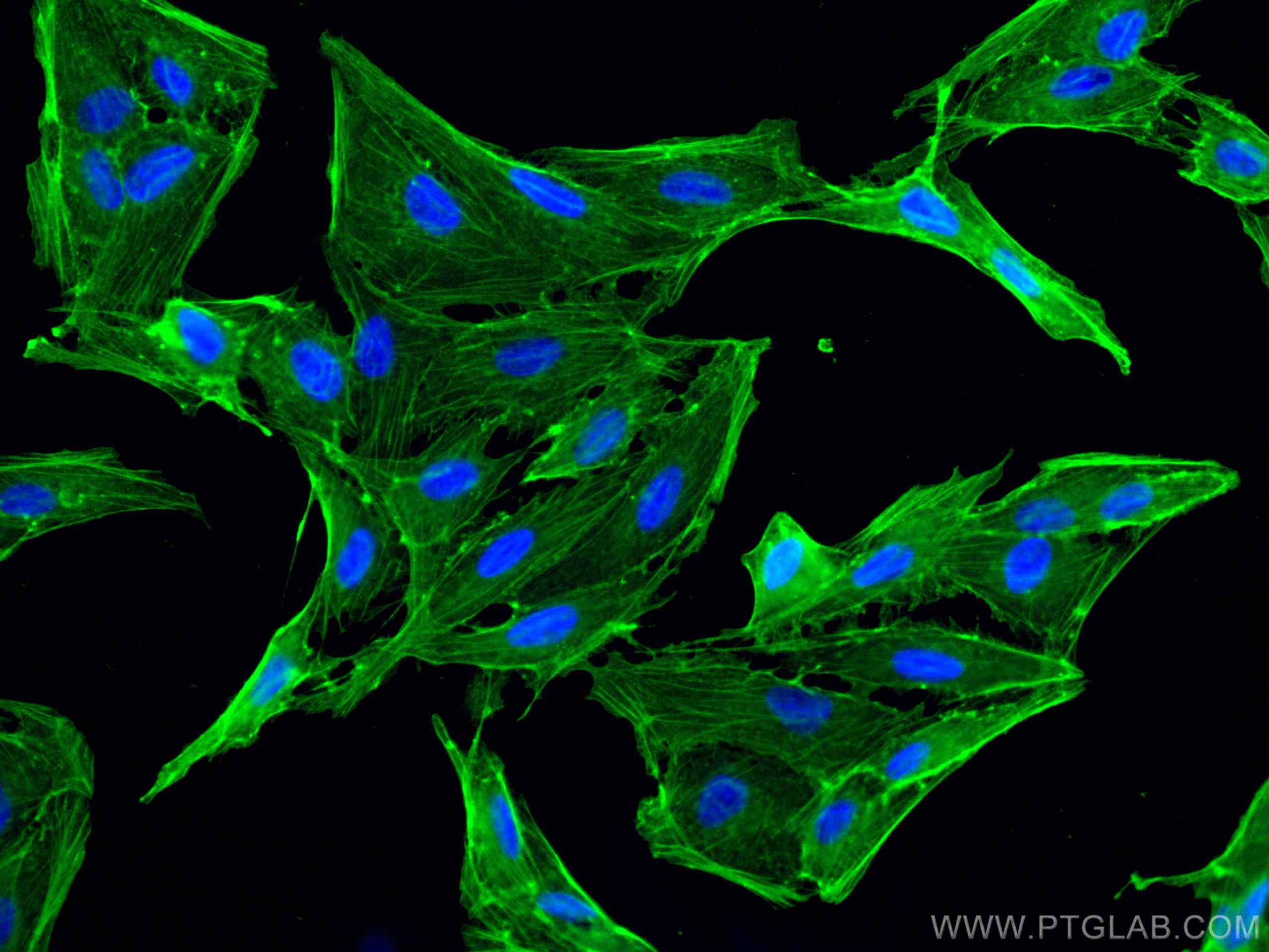 IF Staining of MDCK using 66009-1-Ig