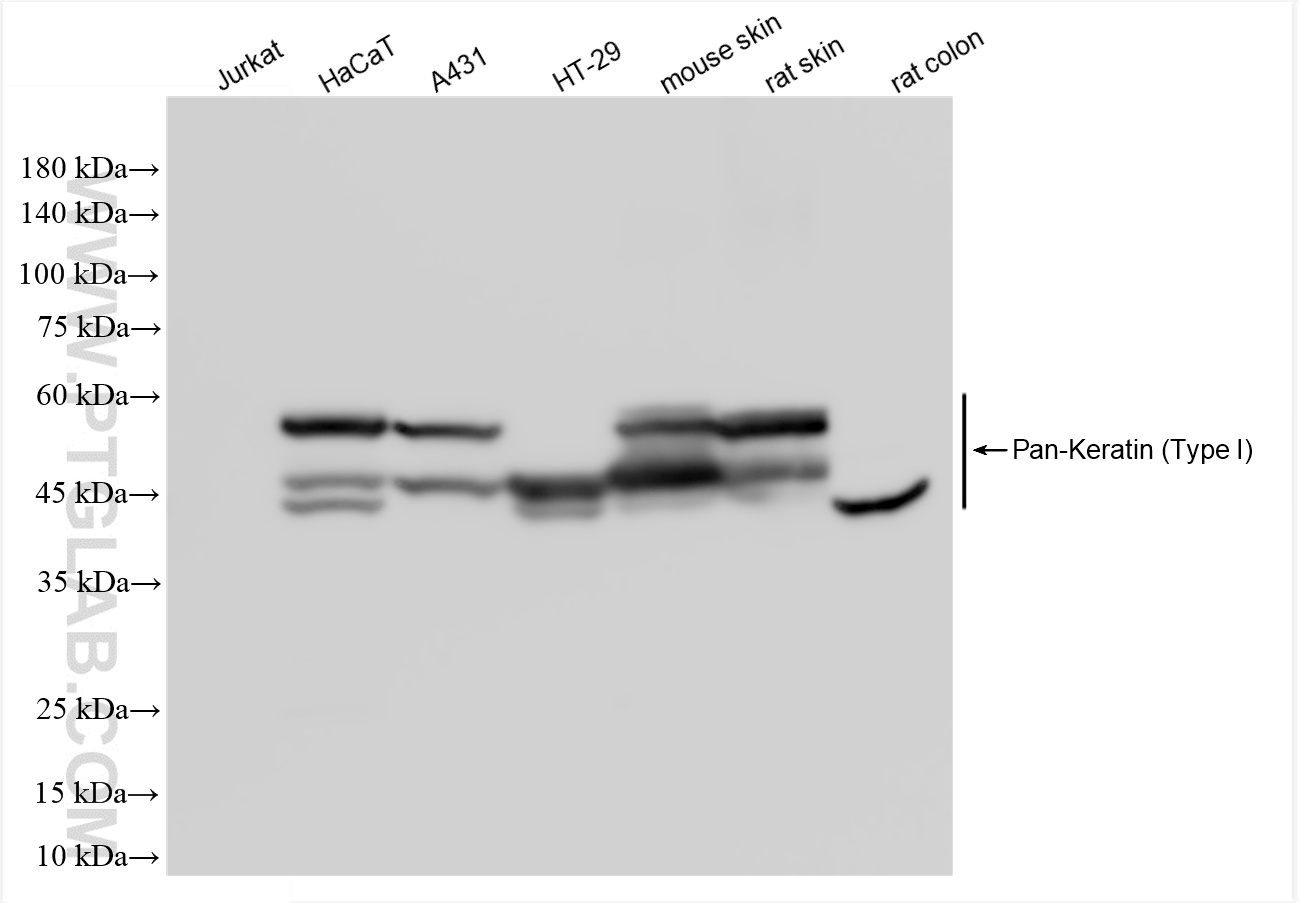 Various lysates were subjected to SDS PAGE followed by western blot with 86238-2-RR (Pan-Keratin (Type I) antibody) at dilution of 1:30000 incubated at room temperature for 1.5 hours. WB analysis using 86238-2-RR
