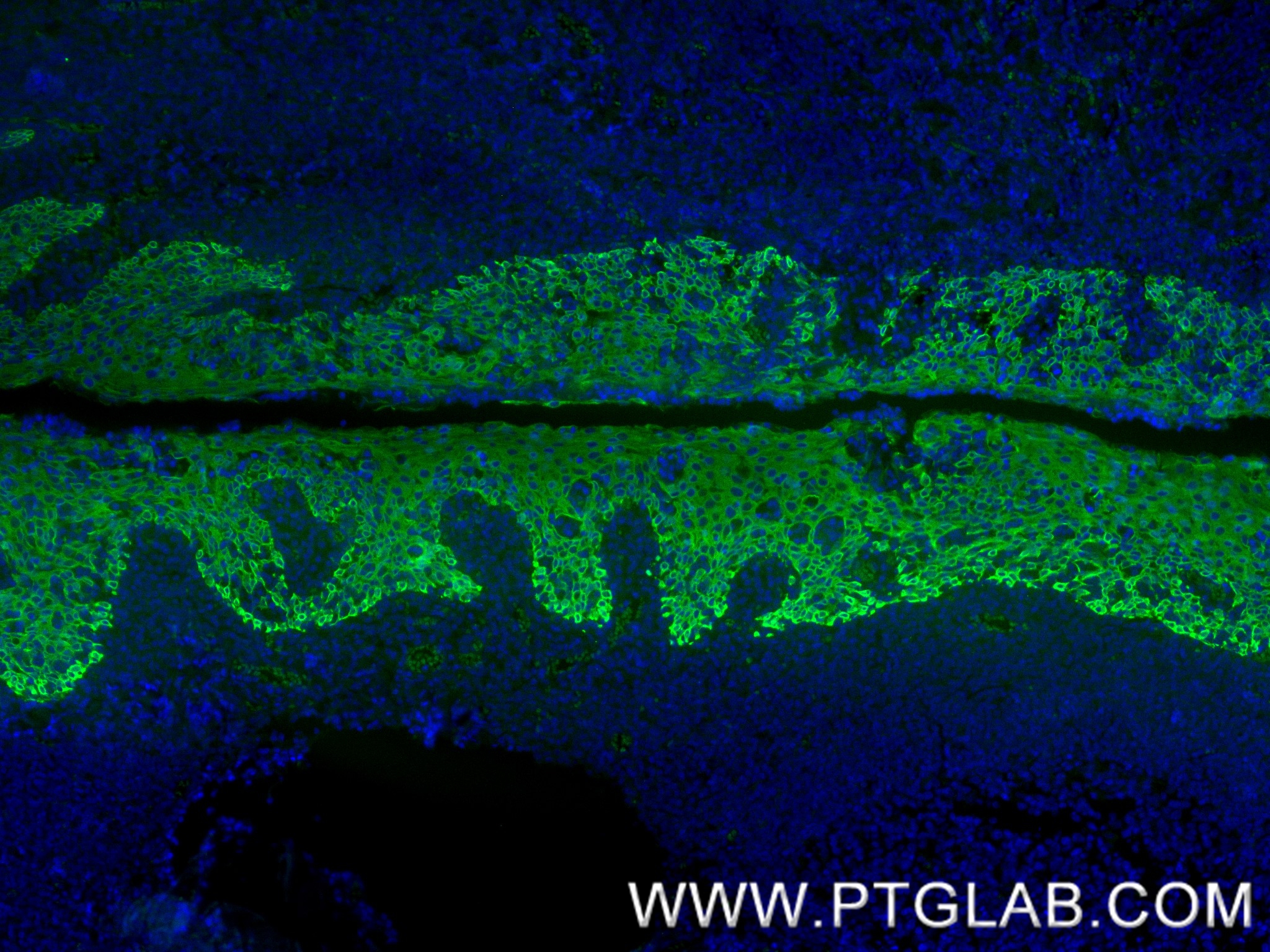 IF Staining of human tonsil using 86238-5-RR