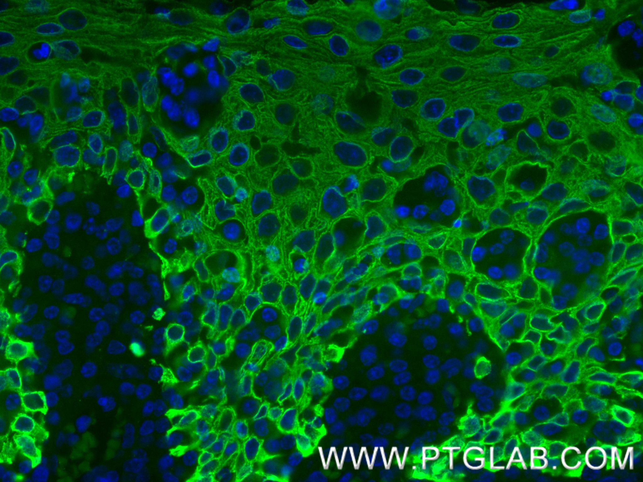 IF Staining of human tonsil using 86238-5-RR