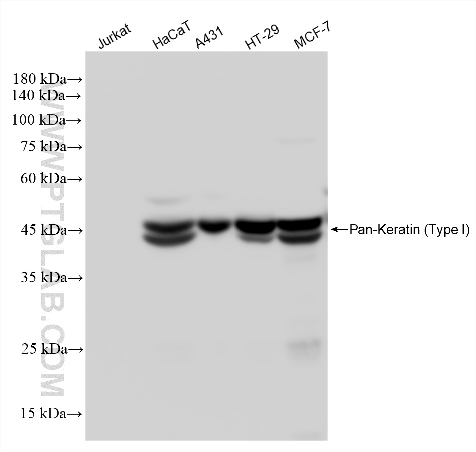 WB analysis using 86238-5-RR