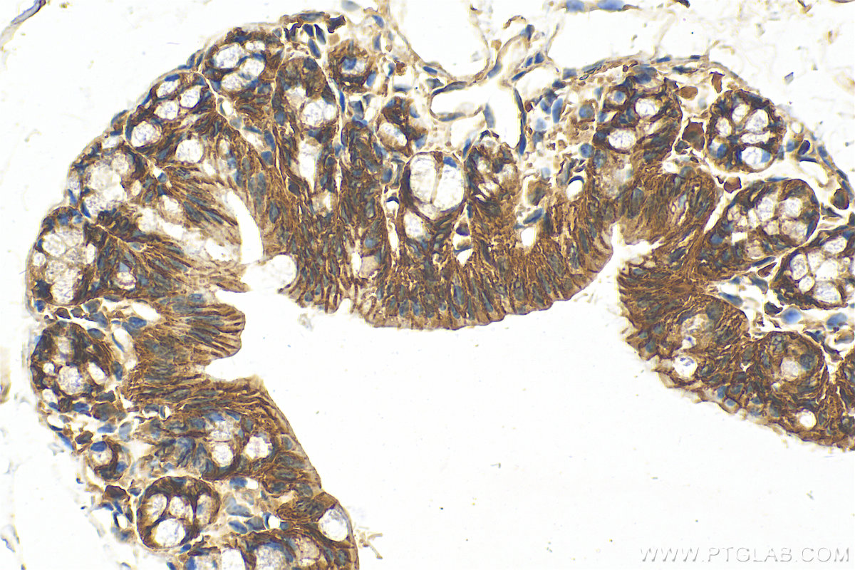 IHC staining of mouse colon using 31313-1-AP