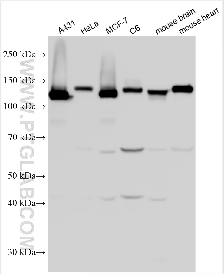 WB analysis using 31313-1-AP