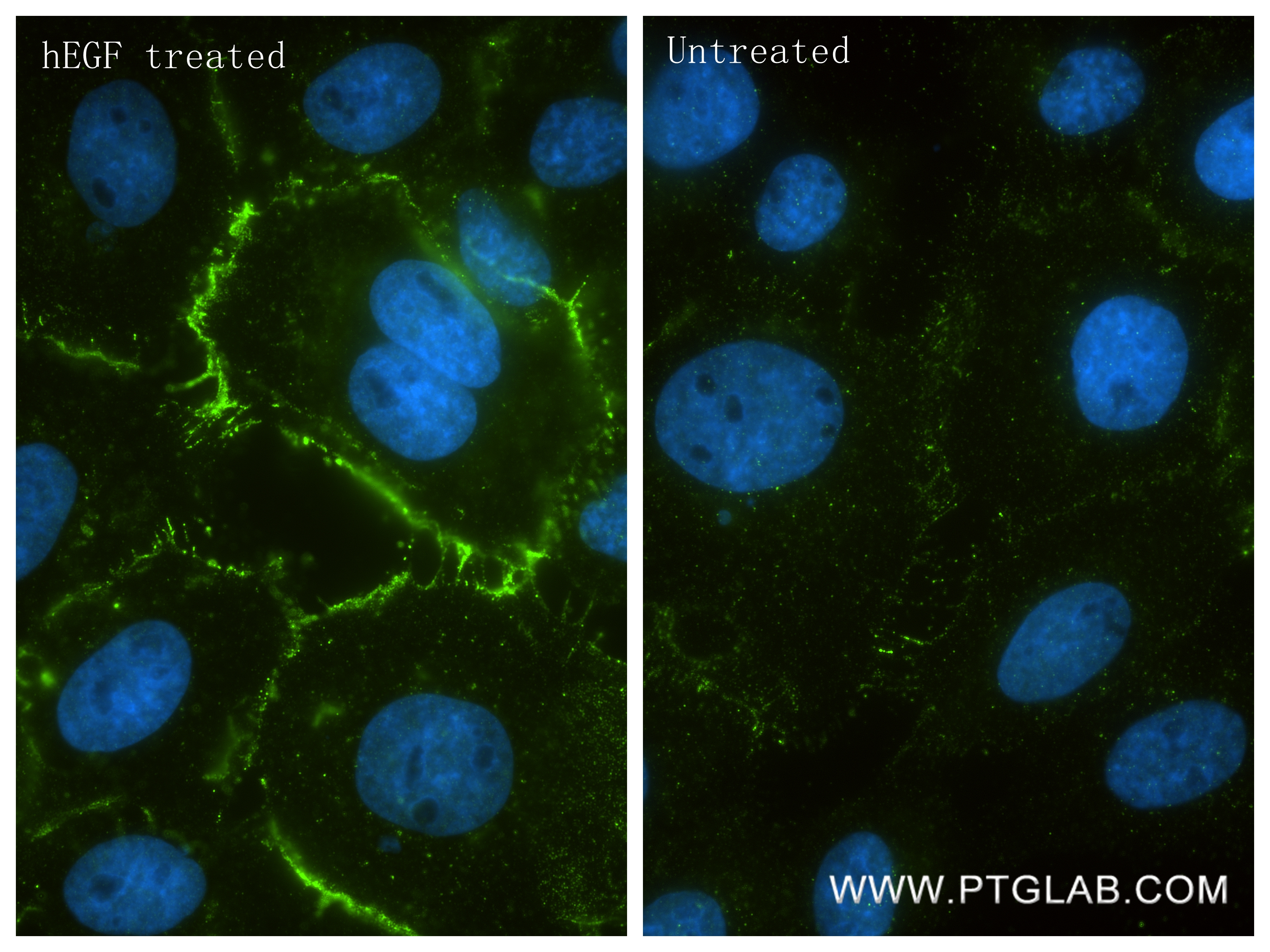 IF Staining of A431 using 86398-1-RR