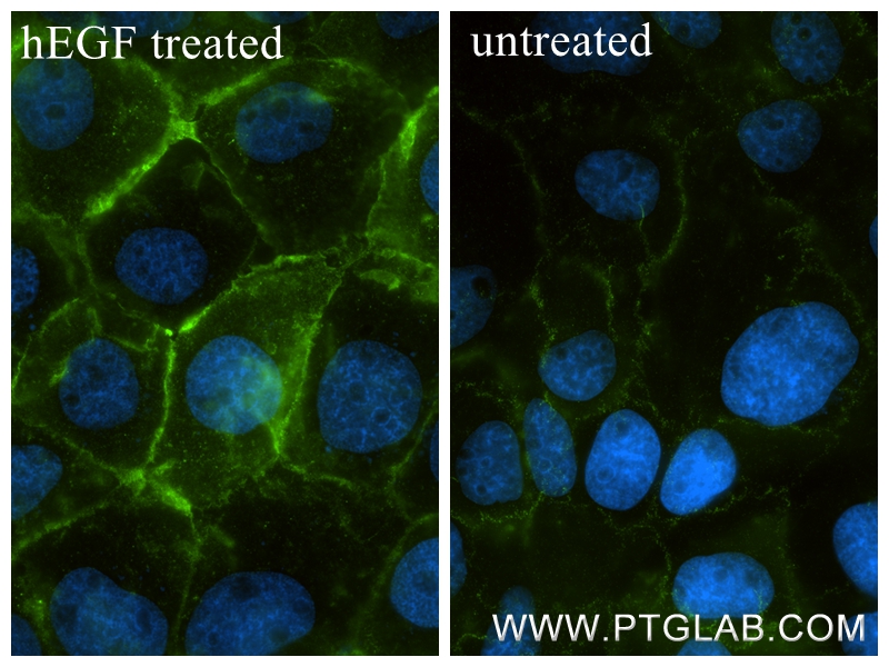 IF Staining of A431 using 86398-1-RR