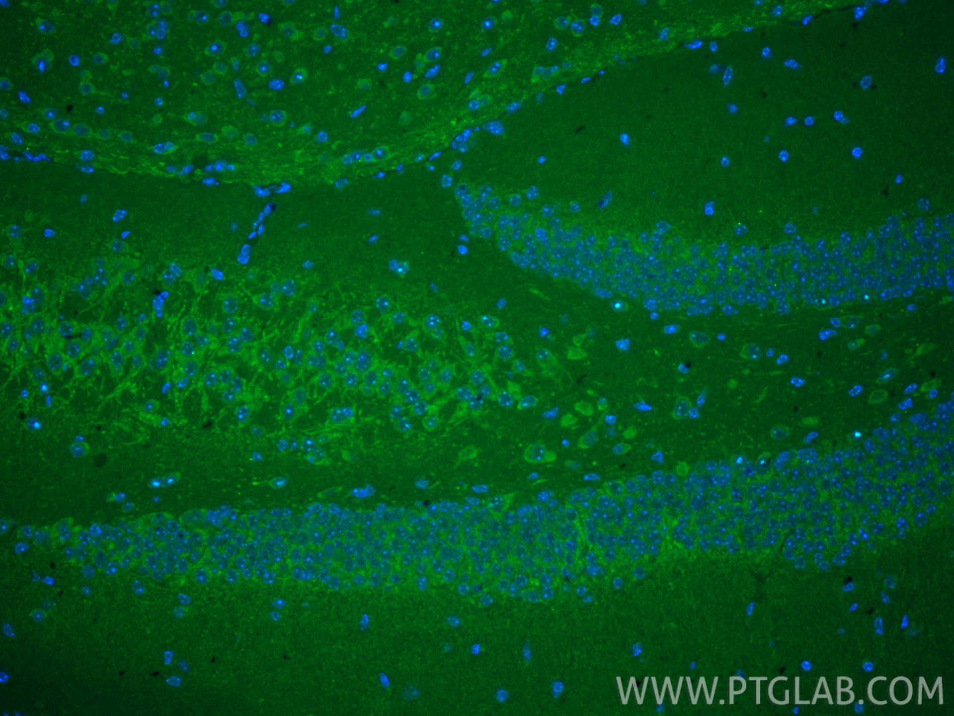 IF Staining of mouse brain using 66674-4-Ig IF Staining of mouse brain using 66674-4-Ig