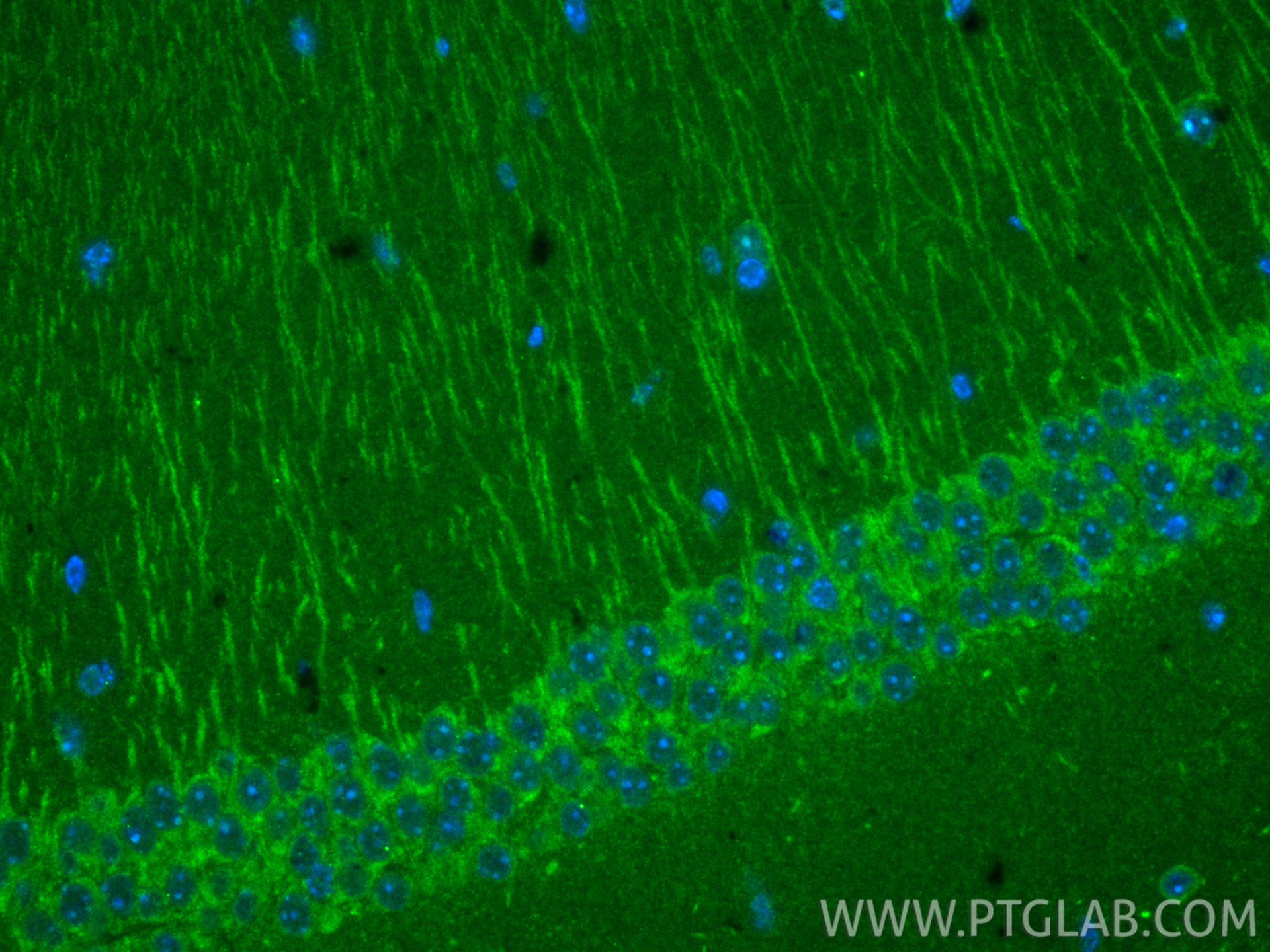 IF Staining of mouse brain using 66674-4-Ig (same clone as 66674-4-PBS) IF Staining of mouse brain using 66674-4-Ig (same clone as 66674-4-PBS)
