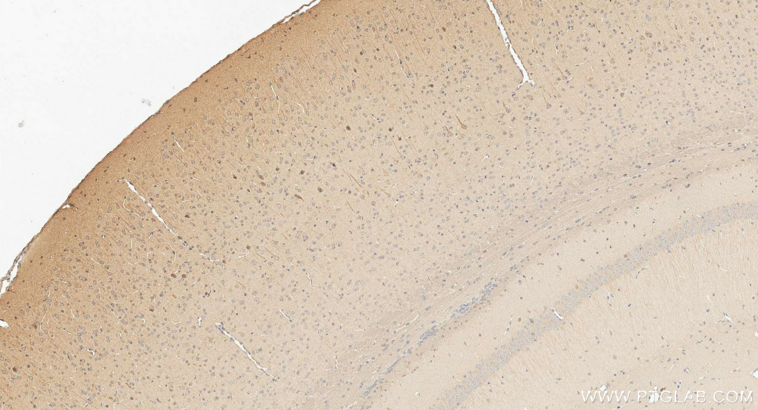 IHC staining of mouse brain using 66674-4-Ig IHC staining of mouse brain using 66674-4-Ig