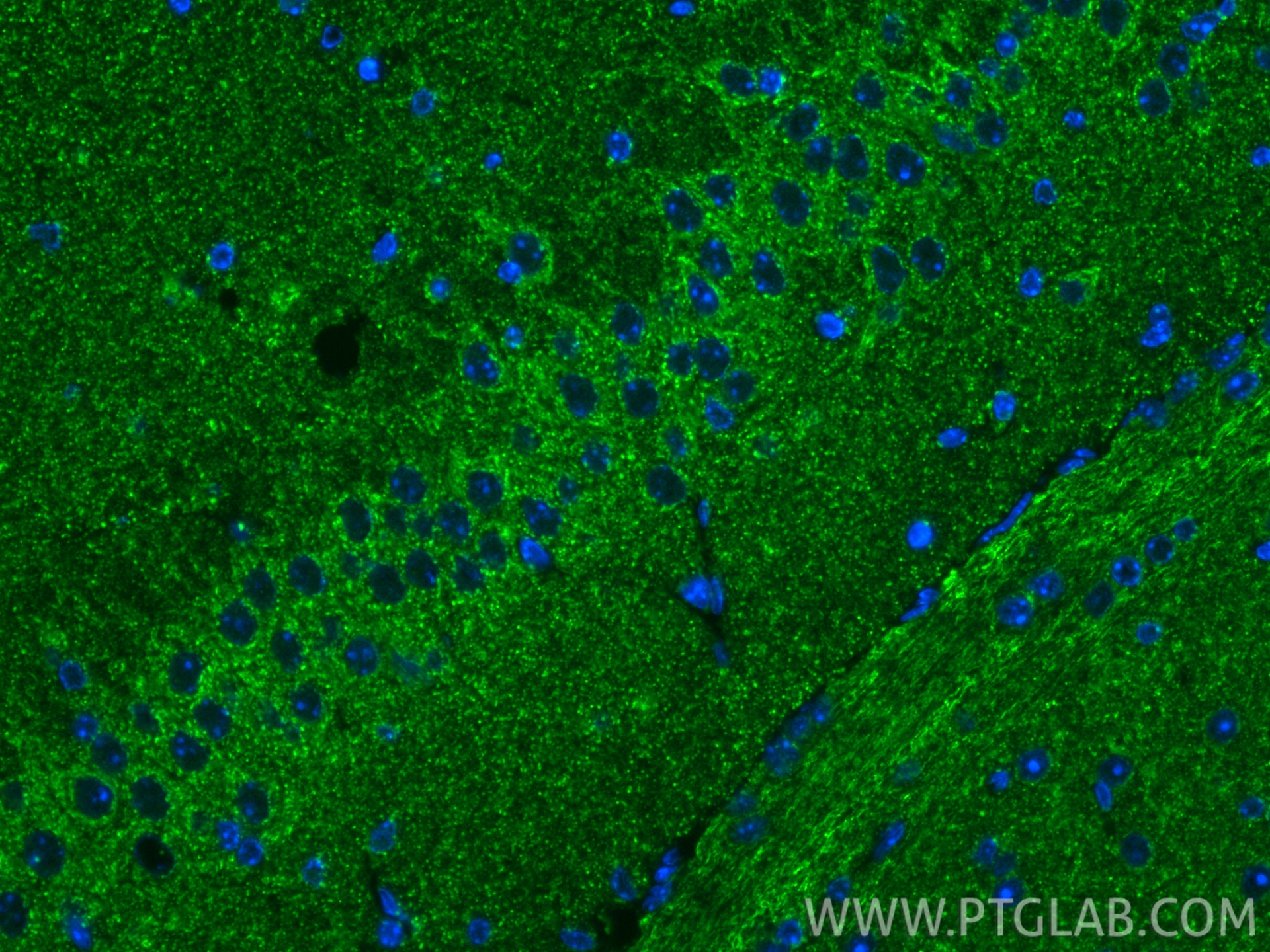 IF Staining of mouse brain using 83224-5-RR IF Staining of mouse brain using 83224-5-RR