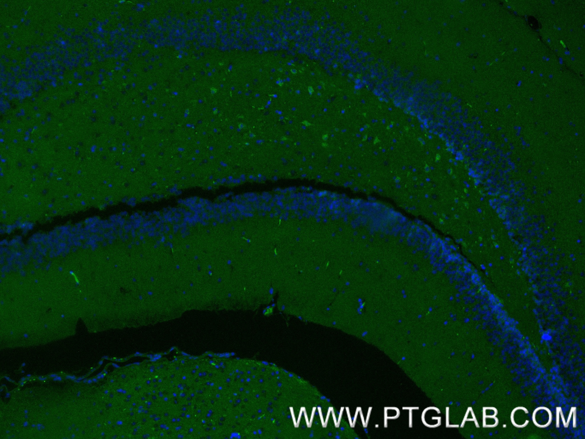 IF Staining of mouse brain using 83224-5-RR IF Staining of mouse brain using 83224-5-RR