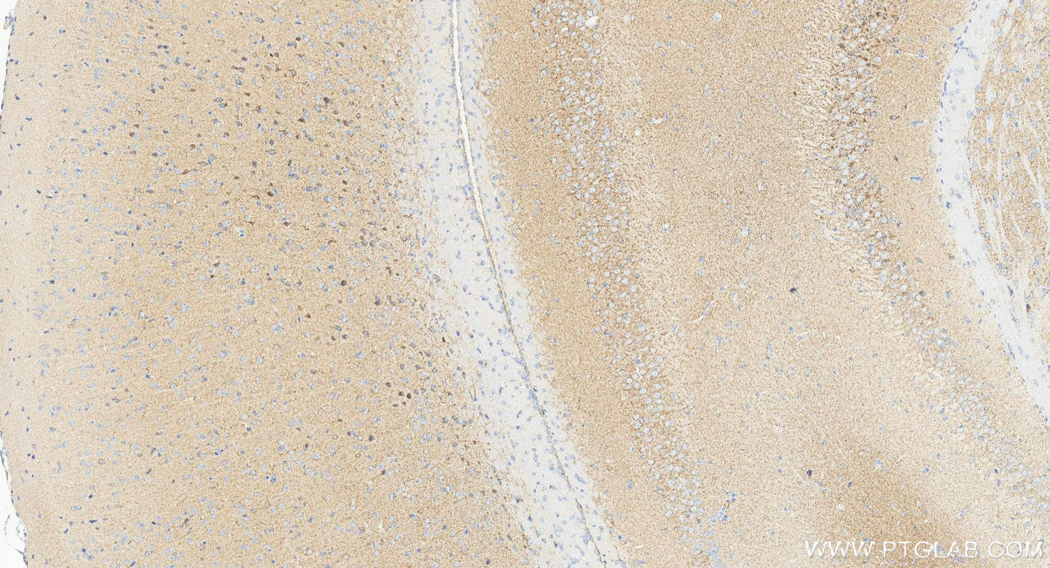 IHC staining of mouse brain using 83224-5-RR IHC staining of mouse brain using 83224-5-RR