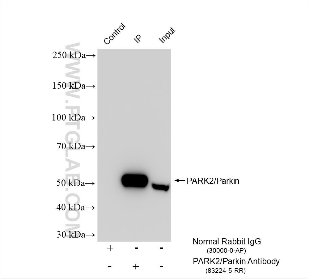 IP experiment of mouse brain using 83224-5-RR IP experiment of mouse brain using 83224-5-RR