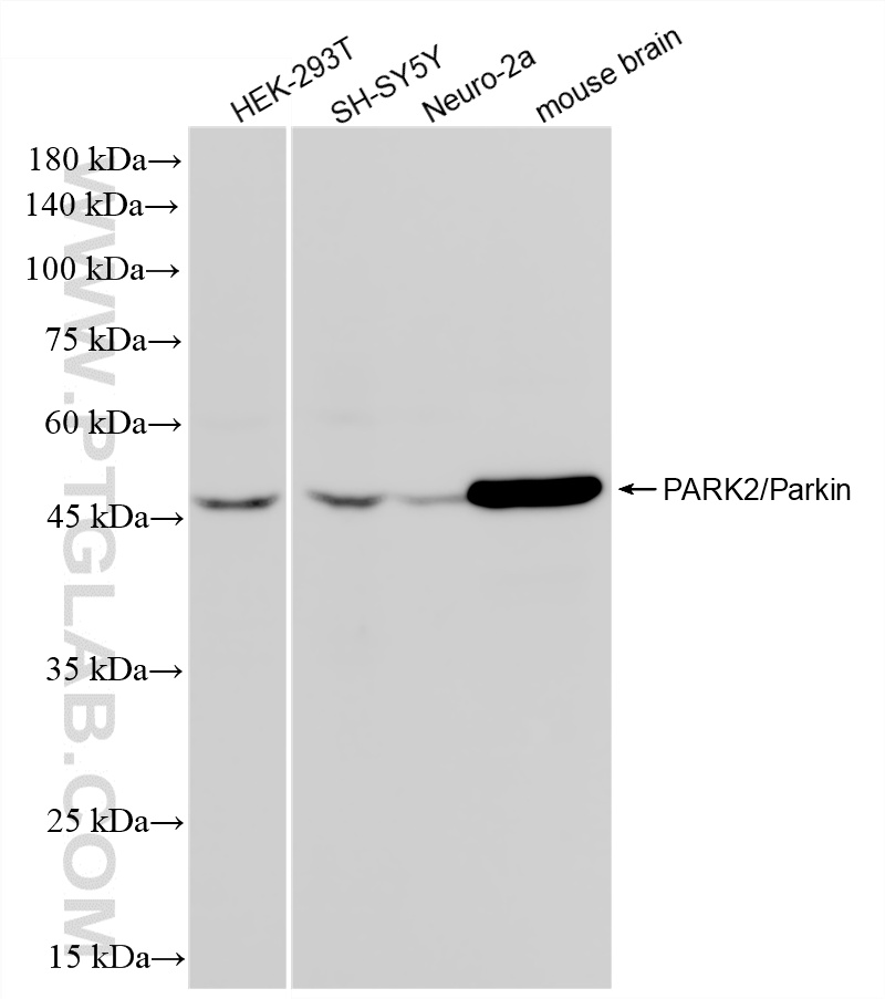 WB analysis using 83224-5-RR (same clone as 83224-5-PBS)