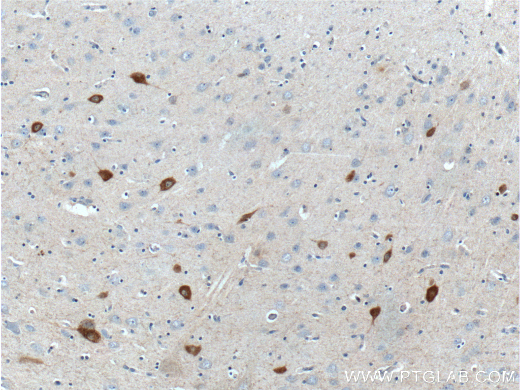 IHC staining of human brain using 26521-1-AP