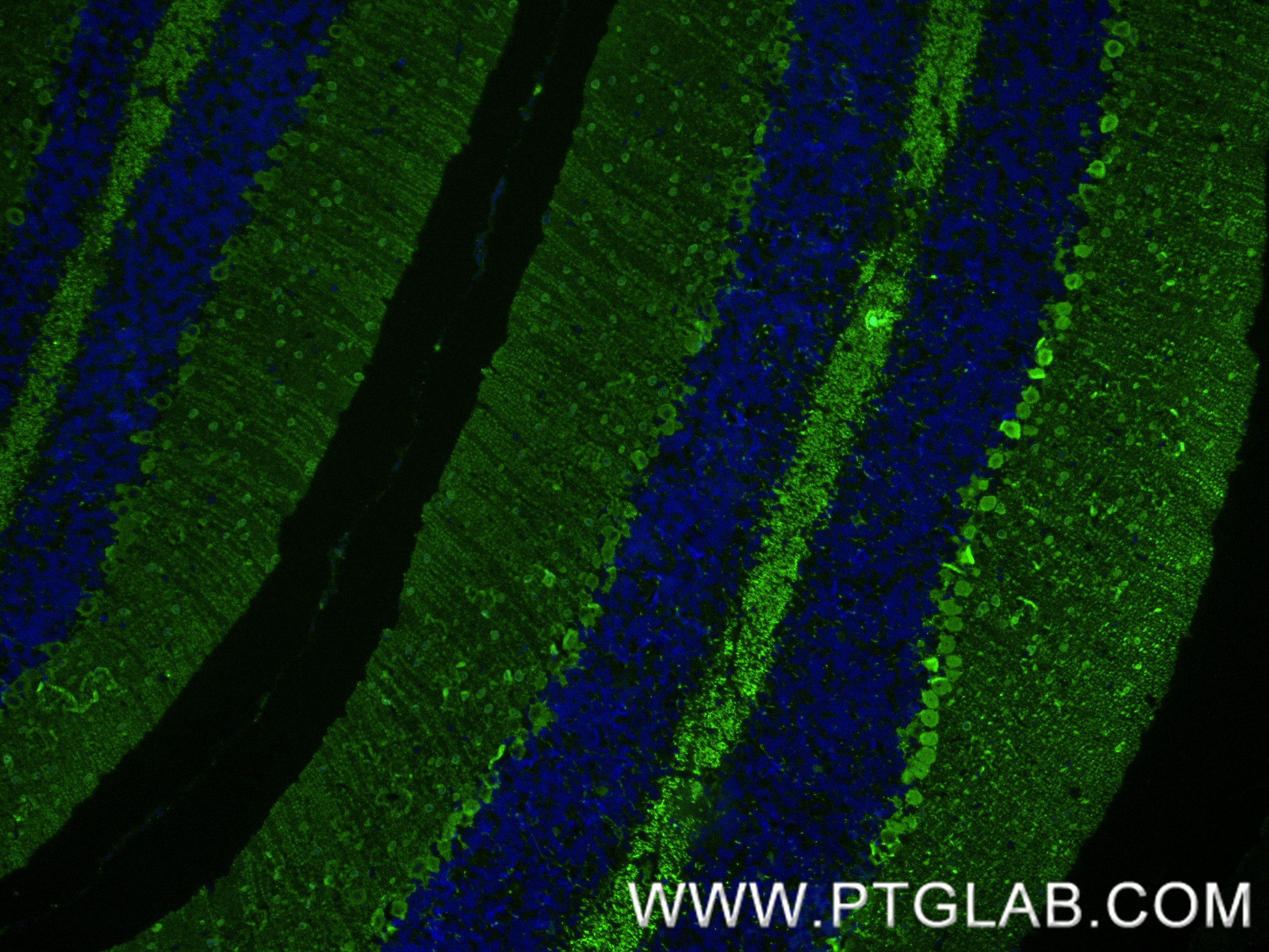 IF Staining of mouse cerebellum using 85819-4-RR