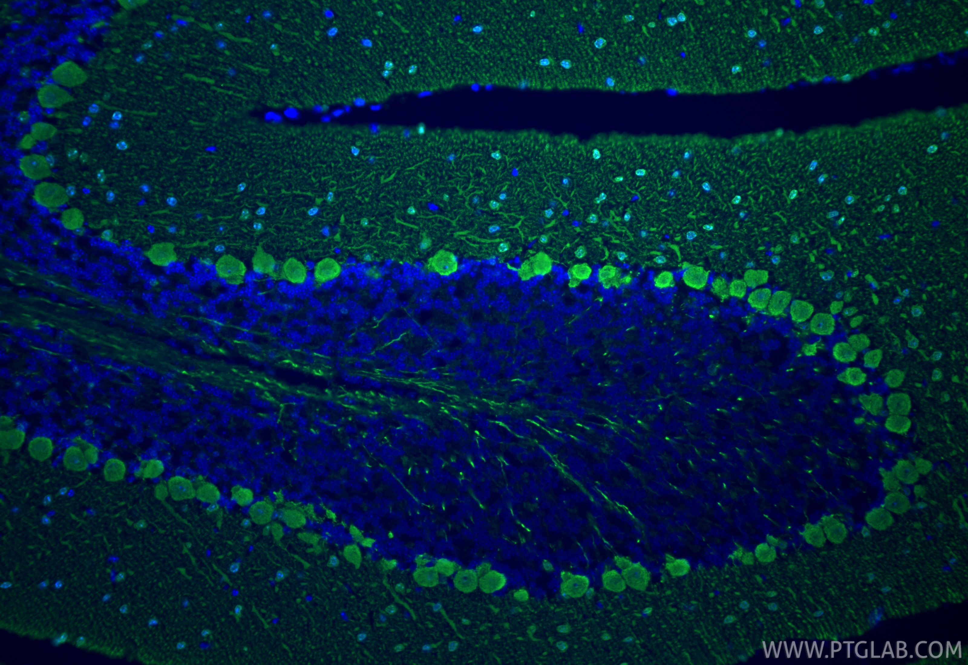 Immunofluorescent analysis of (4% PFA) fixed paraffin-embedded mouse cerebellum tissue using Parvalbumin antibody (85819-4-RR, Clone: 250158B6 ) at dilution of 1:400 and CoraLite®488-Conjugated Goat Anti-Rabbit IgG(H+L) (<a class='green' href='/productredirect?CatalogNo=SA00013-2' target='_blank'>SA00013-2</a>). Heat mediated antigen retrieval with Tris-EDTA buffer (pH 9.0). IF Staining of mouse cerebellum using 85819-4-RR