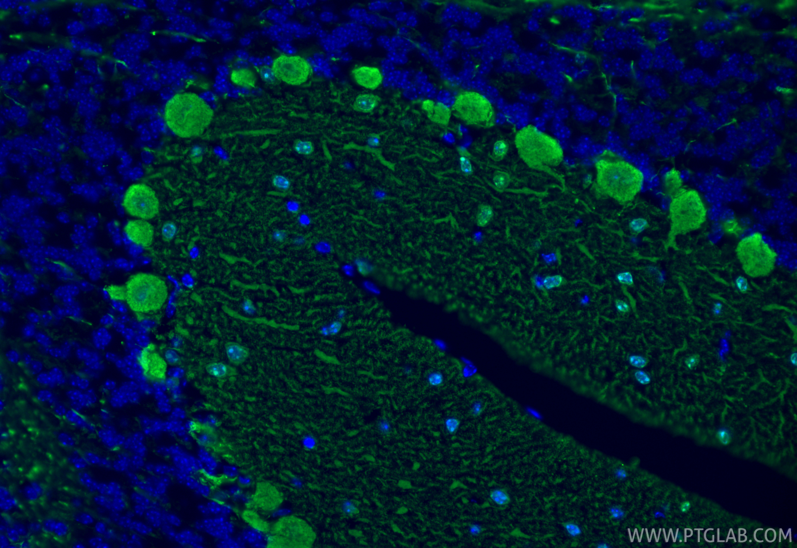 Immunofluorescent analysis of (4% PFA) fixed paraffin-embedded mouse cerebellum tissue using Parvalbumin antibody (85819-4-RR, Clone: 250158B6 ) at dilution of 1:400 and CoraLite®488-Conjugated Goat Anti-Rabbit IgG(H+L) (<a class='green' href='/productredirect?CatalogNo=SA00013-2' target='_blank'>SA00013-2</a>). Heat mediated antigen retrieval with Tris-EDTA buffer (pH 9.0). IF Staining of mouse cerebellum using 85819-4-RR