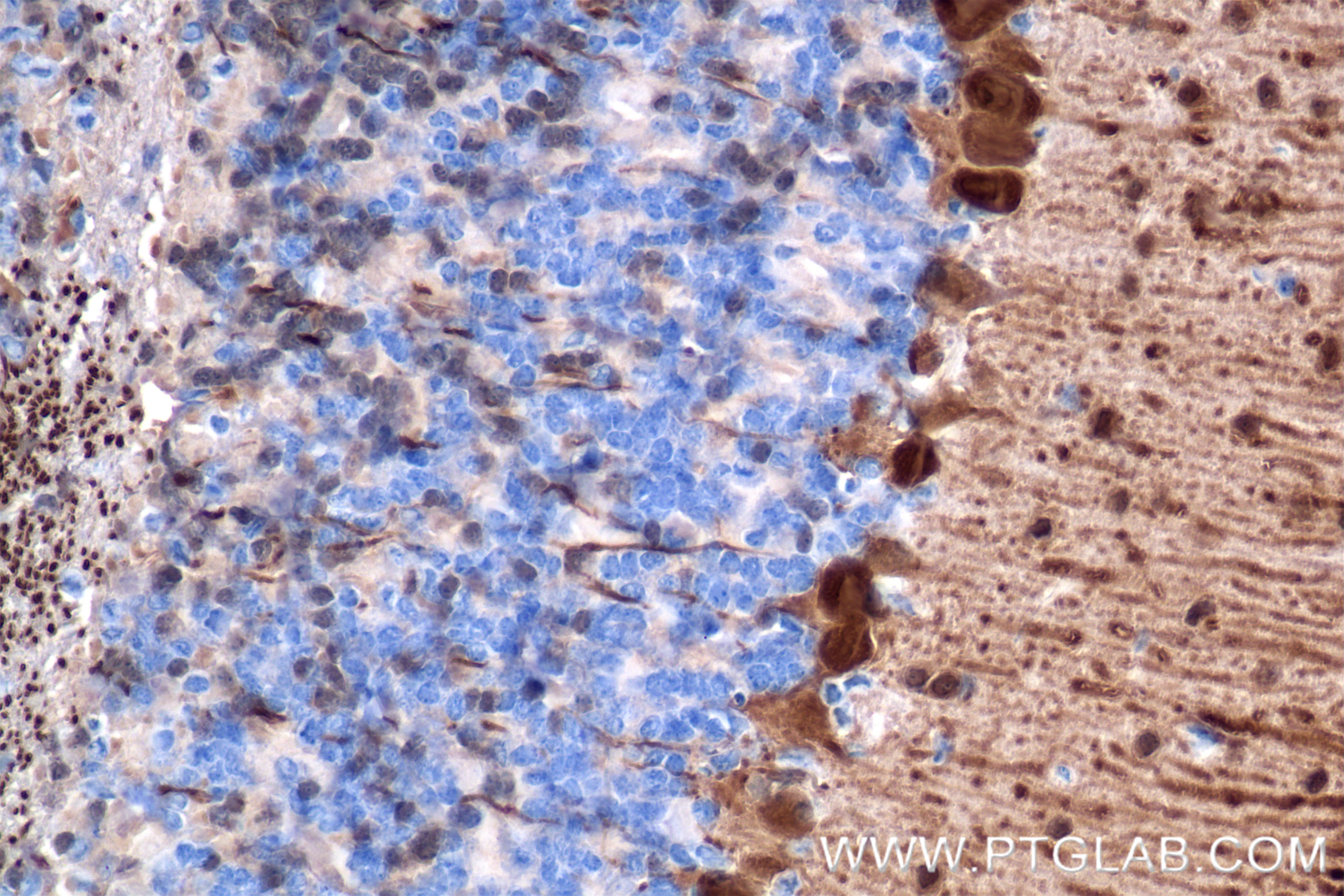 IHC staining of mouse cerebellum using 85819-4-RR