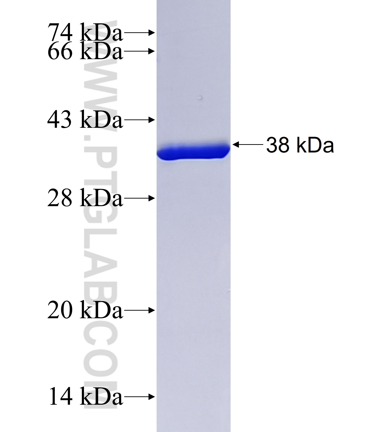 Parvalbumin alpha fusion protein Ag42021 SDS-PAGE Parvalbumin alpha fusion protein Ag42021 SDS-PAGE