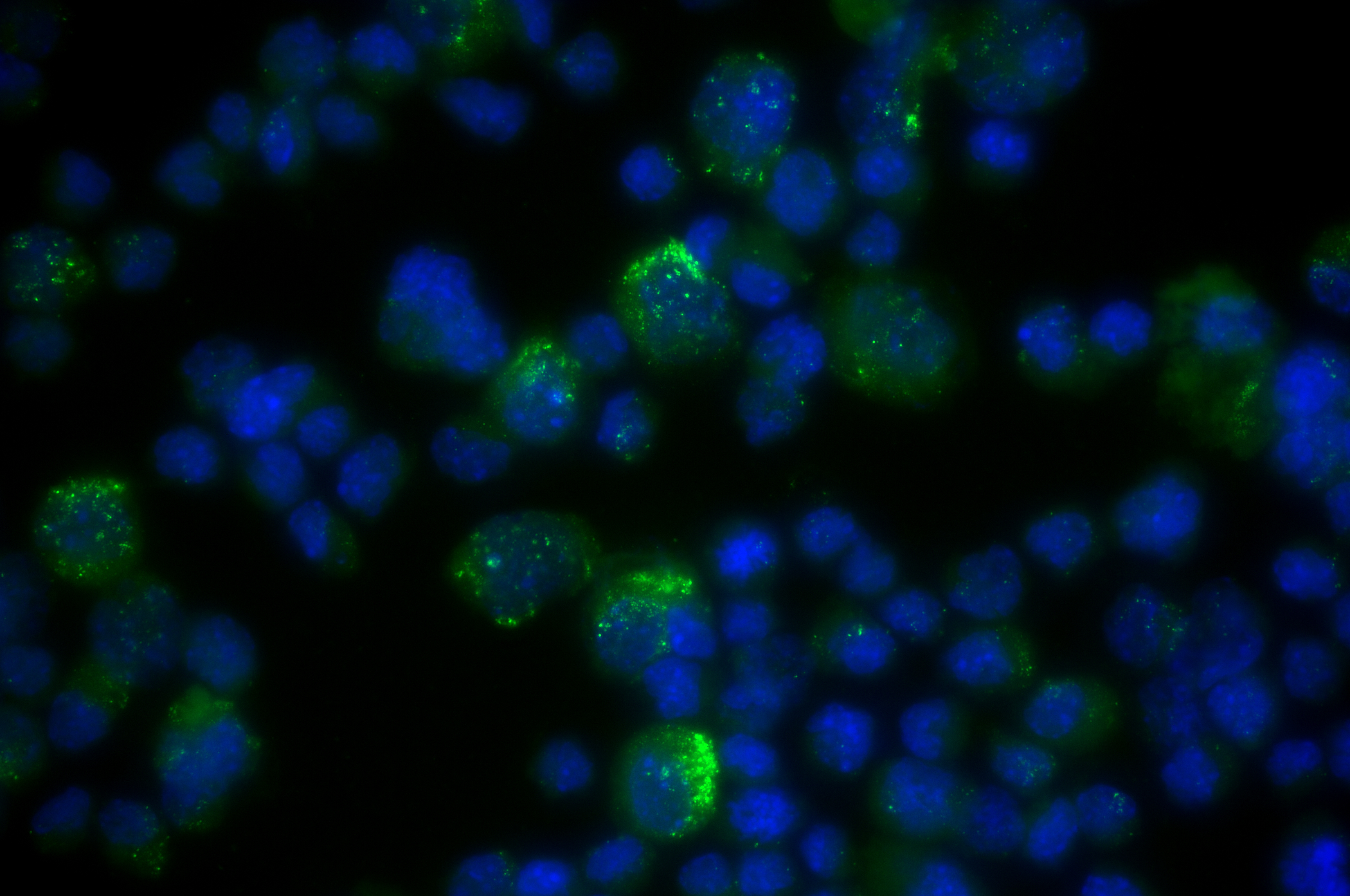IF Staining of CTLL-2 using 83977-1-RR IF Staining of CTLL-2 using 83977-1-RR