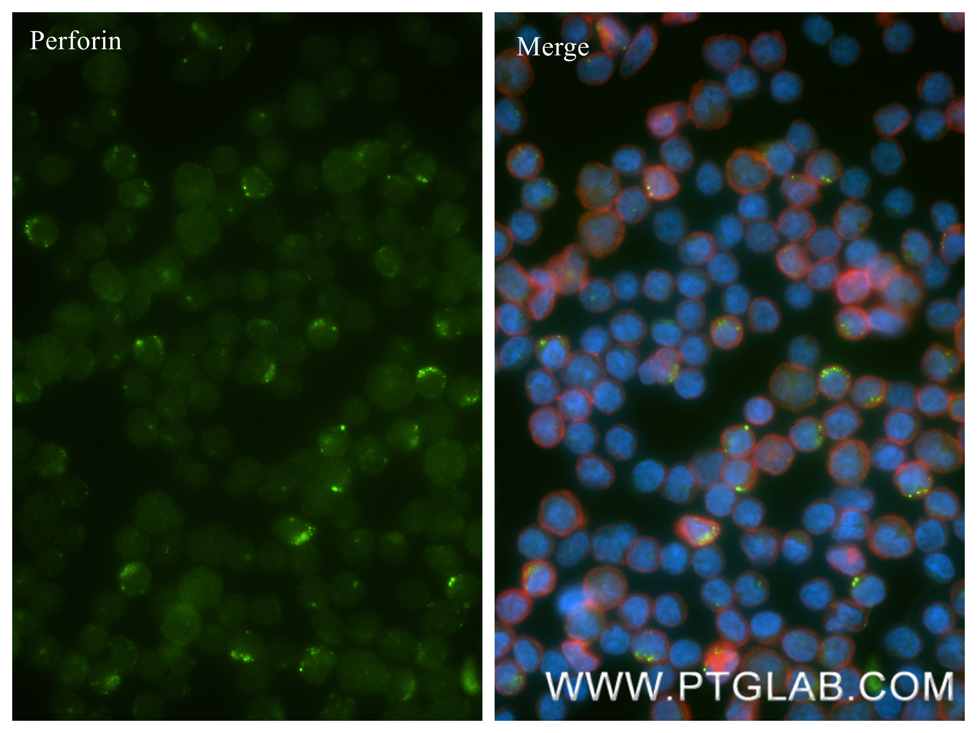 IF Staining of Human PBMC using 83977-1-RR IF Staining of Human PBMC using 83977-1-RR